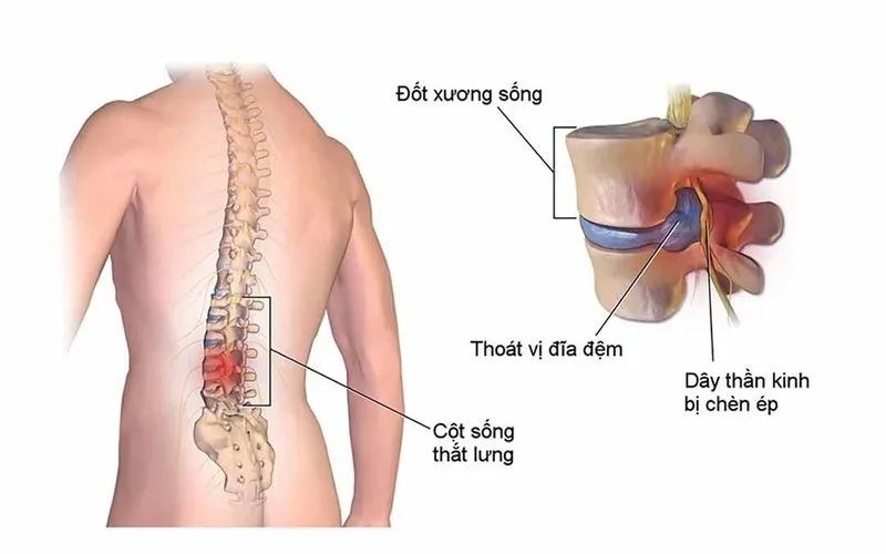 Cung tật ách là gì? Luận giải sức khỏe, bệnh tật trong bản đồ tử vi