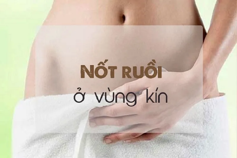 Nốt ruồi ở vùng kín ai cũng chối bỏ hóa ra lại là quý tướng, vạn sự hanh thông