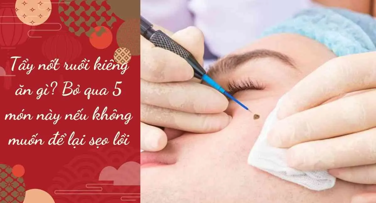 Tẩy nốt ruồi kiêng ăn gì? Bỏ qua 5 món này nếu không muốn để lại sẹo lồi