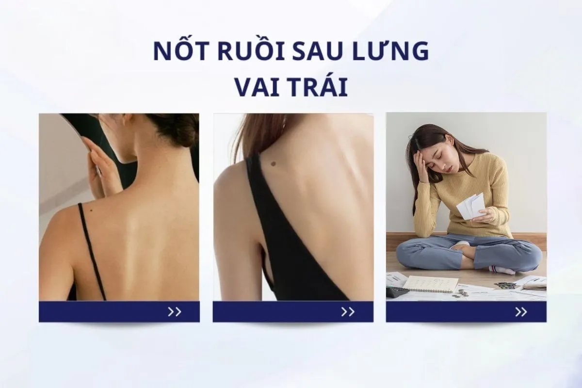 Ý nghĩa nốt ruồi ở vai trái nữ – Tốt hay xấu, hung hay cát