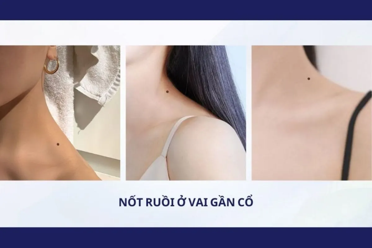 Ý nghĩa nốt ruồi ở vai trái nữ – Tốt hay xấu, hung hay cát